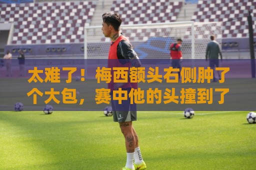 太难了！梅西额头右侧肿了个大包，赛中他的头撞到了对手膝盖